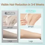 At-Home IPL Hair Removal Device - Lasting Results - Image 4